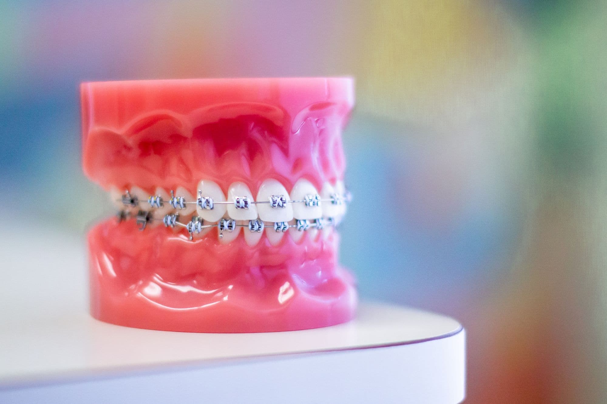 Orthodontist braces uv light hi-res stock photography and images