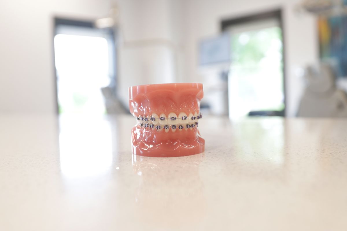 What To Do If My Braces Break? Sturgill Orthodontics