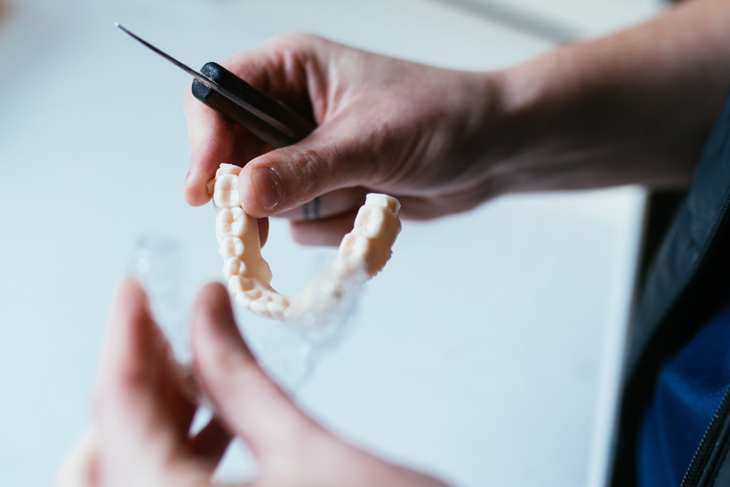 Invisalign Can Effectively Treat Most Overbites in Johnson City, Bristol, and Southwest Virginia